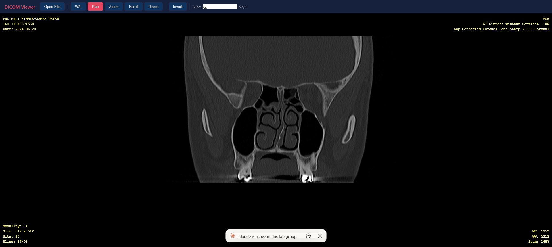 DICOM Viewer